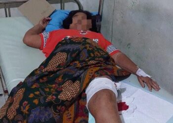 Warga di Tabalong Luka Parah Diserang Beruang Liar