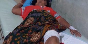 Warga di Tabalong Luka Parah Diserang Beruang Liar
