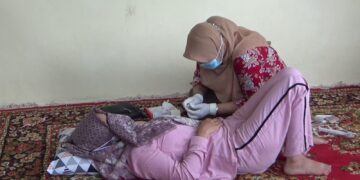 Implan Kontrasepsi “Primadona” di Tabalong 