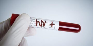 Hampir Semua Kecamatan di Tabalong Terdapat ODHIV