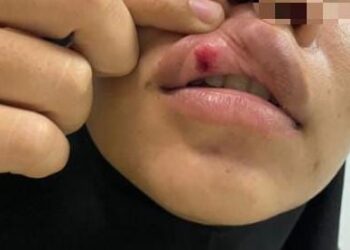 Tak Diberi Uang Beli Obat Terlarang, Suami di Tabalong Aniaya Istri Hingga Pingsan dan Luka-luka