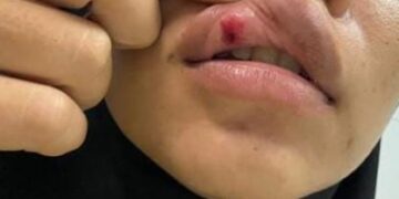 Tak Diberi Uang Beli Obat Terlarang, Suami di Tabalong Aniaya Istri Hingga Pingsan dan Luka-luka